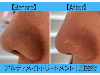 グラサヴォーグ 金沢店/アルティメイトトリートメント♪