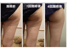 ファロンビューティー(fallon beauty)/痩身効果◎