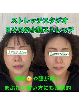 エボ/小顔、頭痛、頭が重い時効果的！