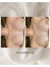 バステト(BASTET)/20代のお客様