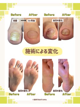 増田健康院/足爪・足裏トラブルでお困りの方
