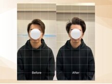 エモア メディカル整体院 恵比寿院(Emoa)/【２０代男性】顔の施術