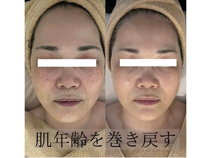 ボニータ(Bonita)の写真