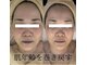 ボニータ(Bonita)の写真