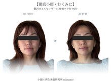 小顔×再生美容研究所ミナモ 福岡店(minamo)
