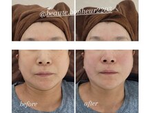 ボーテボナー(Beaute Bonheur)/♪フェイシャル♪