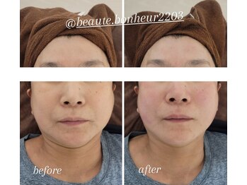 ボーテボナー(Beaute Bonheur)/♪フェイシャル♪