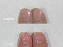 クラウドナイン(Cloud Nine)/ネイルケアのみで縦長な美爪へ