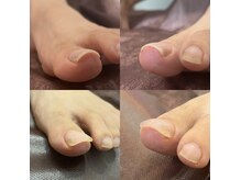 エトレ(EtRe:)の雰囲気（ジェルをしながらの巻き爪ケアが登場！足裏ケアも対応☆）