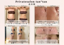 プライベートサロン タンタン(tantan)