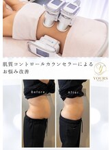 ユアーズビューティー(YOURS beauty) その脂肪 徹底改善