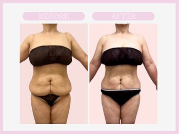 アコガレコガオ 弘前店/