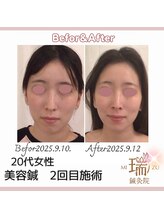 瑞 鍼灸院/ビフォーアフター