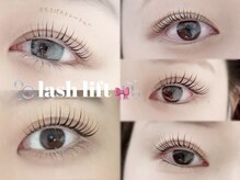 ディンプル(Dimple)