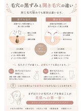 ポリー(Polly)/お悩み毛穴で多い2種
