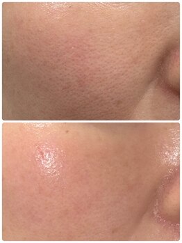 ラン(Ran)/肌変化♪