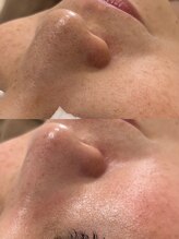 ミュー 岡崎店(mieux)/◇プレミアムコースがおすすめ！