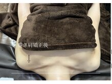 ビノスビューティー(vinos.beauty)/巻き肩矯正で美姿勢をゲット！