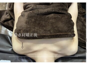 ビノスビューティー(vinos.beauty)/巻き肩矯正で美姿勢をゲット！
