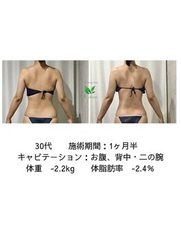 リシャイン(Reshine)/ブライダルダイエット