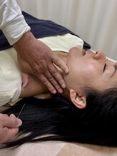 番町もくの木鍼灸院/鍼　頸部施術