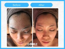 トウメイコガオ 横浜店/トウメイコガオ【ララピール】