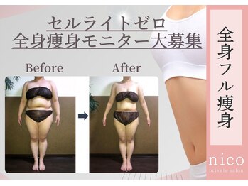 ニコ(nico)の写真/セルゼロモニター募集！！《セルゼロ痩身》キャビ×ラジオ波×引き上げで理想のボディへ♪