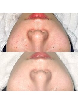 エクリル(Eclire)/クリスティーナ