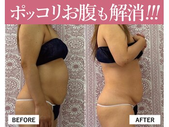 エトワール(etoile)/【ポッコリお腹も解消!】