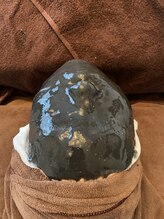 アンリ(Anli)/炭と金粉のパーク美白