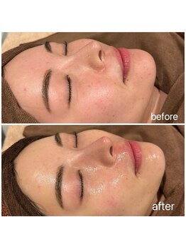 アムールドゥ 麻布十番(Amour deux)/贅沢フルコース4点セット