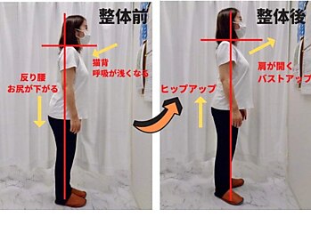 さかぐち整骨院/当院ご来院された方の変化