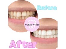 エクシアホワイトニング 王寺店/