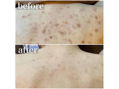 エミルカ 千葉店(EMILUCA)の写真