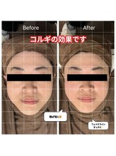 チョアチョア 立川本店(CHOA-CHOA)/回数を重ねるごとに効果が持続！