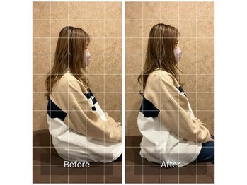 トラスト整体院 小池院/20代/女性/主婦/猫背