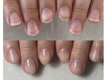 ととりえ/ビフォーアフター