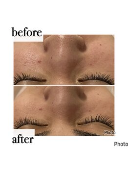 メナードフェイシャルサロン 岐阜茜部/クリーンパック