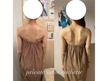 カシェット(cachette)/背中痩せにも効果絶大!!