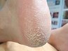 人気！【トータル足裏角質ケア(足裏・かかと)】+【足の爪切り】9,900→8,250
