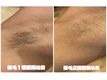 サロン ド ララ(Salon de LALA)の雰囲気（清潔感は肌で決まる♪男性も大歓迎！ツルツル美肌目指しましょう）