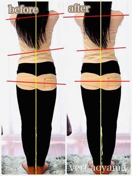 ヴェール 青山(vert)/骨盤矯正【ウェストの左右差】