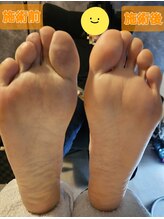 足つぼまーさん/足のむくみがスッキリ！！