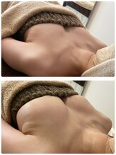 ラディス(Radice.)/【バストアアップ症例】☆