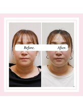 ル フラーズ(Les Fleurs)/全身矯正