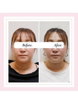 ル フラーズ(Les Fleurs)/全身矯正