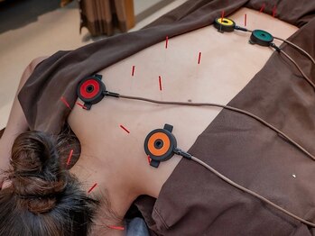 高田馬場はりきゅう院【首肩こり/腰痛/眼精疲労/ヘッドスパ/生理/自律神経/美容鍼】の写真/【12月掲載開始】国家資格保有者による本格施術！これまで改善しなかったお悩みを根本改善へ徹底ケア◎