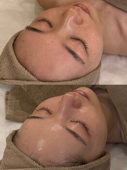 セレニテ(Serenite)/