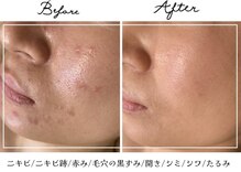 アリュール(ALLURE)