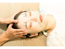 美容鍼灸サロン　Hari alr. [ハリ エール]　美肌/小顔/整体/美容鍼